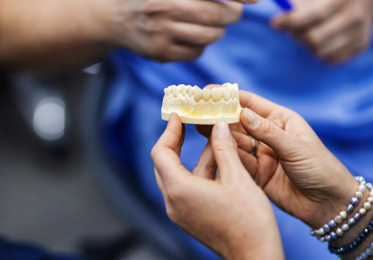 Implanty zębów – dlaczego warto?