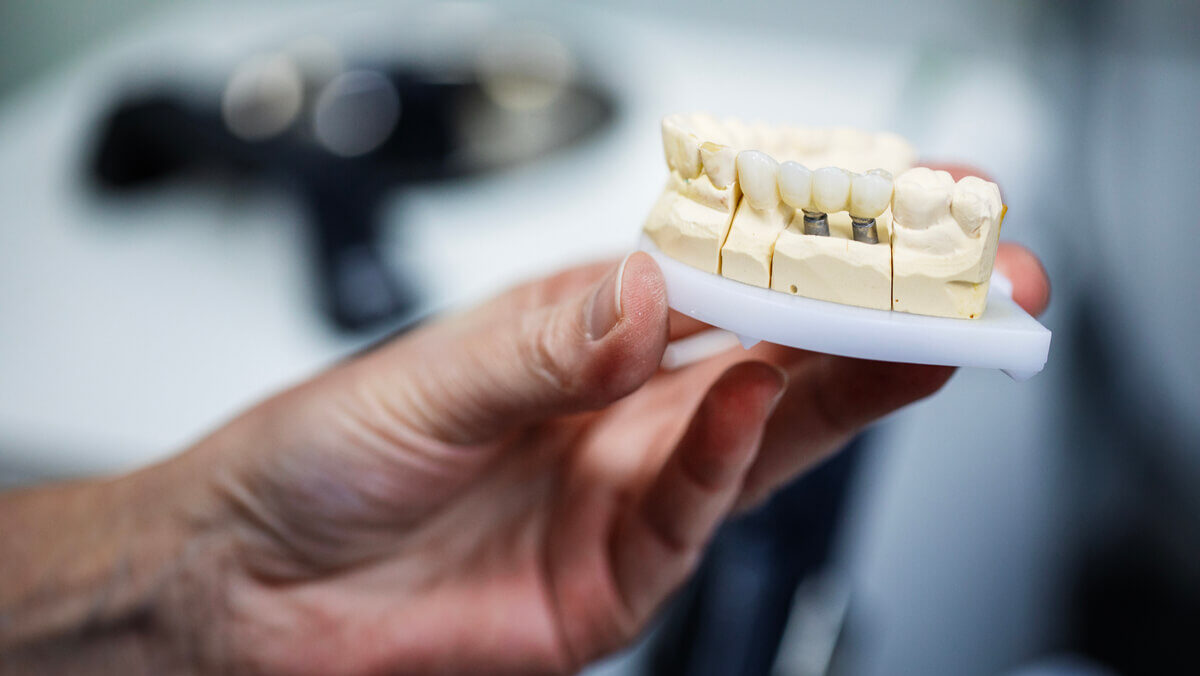 Implanty zębów Toruń