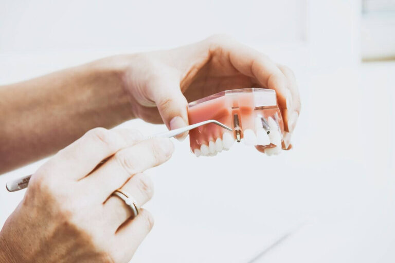 Koszt implantów stomatologicznych